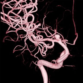 脳血管撮影・治療装置の写真03